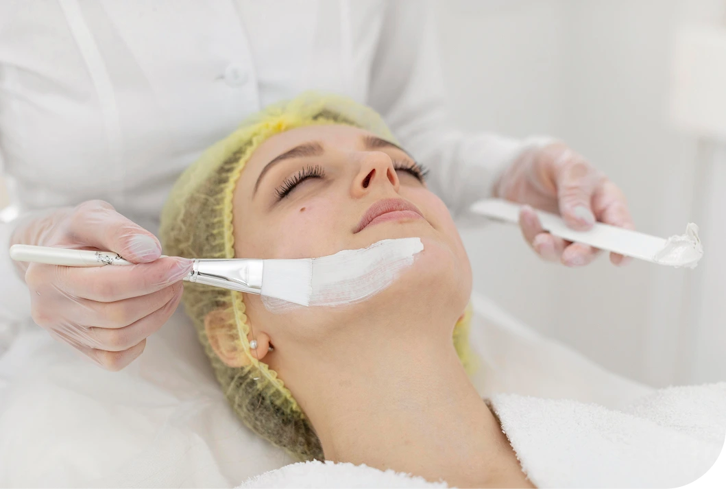 What Is an Acid Peel in Starke, FL Banner