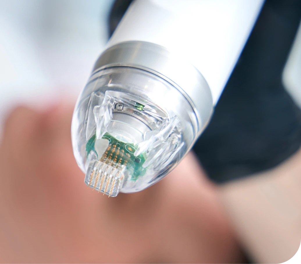 RF Microneedling in Starke, Florida Banner